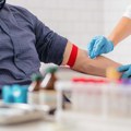 Krv danas možete dati na samo jednom mestu u Beogradu