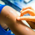 Evo koje simptome izaziva virus koji se širi svetom: Ove grupe ljudi su posebno ugrožene