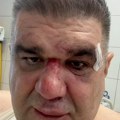 MENADžER Saša Mirković završio u bolnici rebro u Zagrebu Evo šta je imao da poruči javnosti (video)