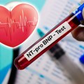 Test NT-proBNP – važan marker zdravlja srca: Kada povišene vrednosti mogu ukazivati na srčanu slabost?