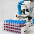 Posle iznenadnih testova na drogu, nekoliko zaposlenih u francuskoj vladi dobilo otkaz