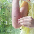 "U ovom slučaju se obavezno obratite lekaru" Doktor Milićević za Kurir otkrio kako se zaštititi od komaraca: Ovi insekti…