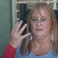 Žena doživela horor u dvorištu Napali je zmija i jastreb, pogledajte kako joj izgleda ruka (video)