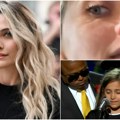 DžEKSONOVA naslednica šokirala javnost ukazavši na tragove zavisnosti Paris pokazala nos s rupom usled gubitka hrskavice