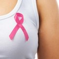 Rak dojke na trećem mestu kao uzrok smrti kod žena