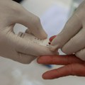 Epidemiolog Milosavljević: U Srbiji se živi sa HIV-om, ali je rano otkrivanje važno