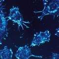 Tečna biopsija - nova i brža tehnologija za otkrivanje raka