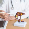 Nova saznanja o masnoj bolesti jetre: Prirodna supstanca pokazuje zaštitni efekat već u prenatalnom periodu