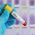 Delić: Denga, zika i čikungunja - tri virusne infekcije koje će globalno otopljavanje doneti u Srbiju