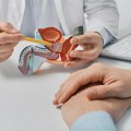 Radioterapija karcinoma prostate – kada se primenjuje?