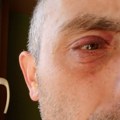 „Jajima gađaju naprednjaci, a ne građani“: Nišlija Dušan Ilić prijavio policiji da ga je napala i povredila grupa…