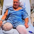 Legendarnom rvaču amputirali nogu: Neprepoznatljiv iz bolničke postelje rastužio svet