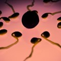Da li upotreba saune zaista može smanjiti broj spermatozoida