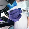 Povišeni leukociti nisu uvek znak infekcije: Evo na koja sve stanja mogu da ukazuju