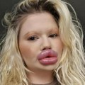 Imam najveće usne na svetu, ali sam uradila novi zahvat: Andrea dala milione plastičnom hirurgu, a sada odbijaju da je…