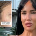 "Moje dete je pretučeno" Aleksandra Subotić objavila potresne slike ćerke, na licu i vratu ogrebotine