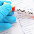 Test koji otkriva kako organizam koristi gvožđe: Šta znače visoke, a šta niske vrednosti?