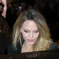 Svet netremice gleda upropašćeno lice Anđeline Džoli: Otkriveno šta stoji iza ovako nesrećnog rezultata (foto)