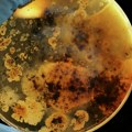 Naučnici otkrili više od 30 dosad nepoznatih vrsta bakterija u uzorcima pacijenata