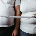 Ona ne izaziva samo hronične bolesti, već i druge posledice: Danas je Svetski dan borbe protiv gojaznosti