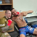 Kako izgleda Brazilac posle borbe sa Vasom Bakočevićem: "Napravio sam mu nova usta"