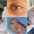 Zahvatom „zub u oku” vratili mu vid nakon dve decenije Kanada slavi uspeh procedure „na granici naučne fantastike”