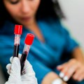 Revolucionarni test krvi mogao bi da otkrije 50 vrsta raka