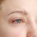 Crvene oči nakon buđenja: Optometrista otkriva moguće uzroke krvavih beonjača