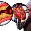 Nutricionisti otkrivaju: Ovo je pet zabluda o holesterolu
