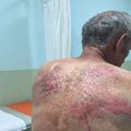 Srpska lista: Kosovska policija pretukla Srbina, odveden u šumu i vezan za drvo