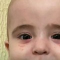 Viktor ima samo dve godine i izborio se za život! Nedostaje malo novca da bi imao i svetliju budućnost