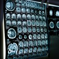 Odmah reagujte na ove signale Mozak nam s godinama propada i kognitivne sposobnosti opadaju što smo stariji neurolog skreće…