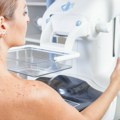 Vranjanke više ne moraju u Niš na mamograf, počeo sa radom najnoviji, direktorka RFZO: Uskoro stiže i magnet