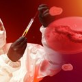 Virus šamonda prešao na čoveka prvi put u istoriji: Naučnici otkrivaju da li postoji razlog za strah