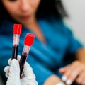 Revolucionarni test krvi mogao bi da otkrije 50 vrsta raka