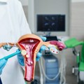 Ciste ili miomi? Ginekolog upozorava kada je vreme da tražite pomoć lekara VIDEO
