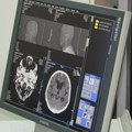 Ginekološki karcinomi pogađaju više od 4.000 žena godišnje