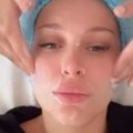 Luna Đogani opet kod plastičara: Evo šta ovog puta koriguje: "Mom licu ovo treba" (foto)