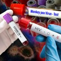 Najmlađa HIV zaražena osoba u Srbiji ima samo 16 godina: Zaštita od ovog virusa nikad nije bila dostupnija, evo šta sve…