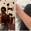 Ljudi su me zezali zbog rana i ožiljke po telu, ali oni ne znaju jednu stvar: Isidora je rođena sa ovom bolešću, usledio je…