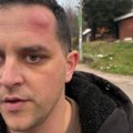 Poslanik ZLF koji je napadnut u Mionici: „Pribili su me uza zid i udarali šipkom“