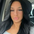 Nina Đogani smanjila usne! Usnimila ceo proces i rezultat - Ogromna razlika pre i posle, ovo je njen prirodni izgled! (foto)