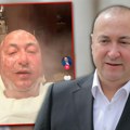 Ne lickaju se samo keba i miloš bojanić! Đani uradio ful tretman lica i to u Dubaiju: Ovo su mu poručili fanovi