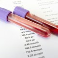Veliko otkriće! Naučnici otkrili kakve vrednosti u krvi morate imati da bi živeli duže: "Žene su u velikoj prednosti!"