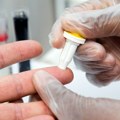 Ovo su četiri faktora koja prethode gotovo svakom srčanom i moždanom udaru