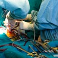 "Nije bilo spasa, morali smo da amputiramo ruku": Užas na VMA, Beograđanin došao sa smrskanom podlakticom, zabeležen i…