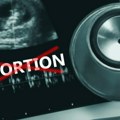 Uvode pravo na abortus u Ustav? Još jedna zemlja se odlučila