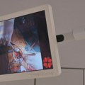 Hirurg u Beogradu, pacijent u Belgiji: U KCS izvedena prva telehiruška operacija na ovim prostorima