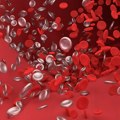 Simptomi koji mogu ukazivati na visok holesterol i zapušene arterije