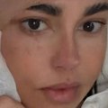 Gazu drži na licu, glava zavijena! Oglasila se Dijana Dilajn nakon operacije: "Tri i po sata je trajala..."